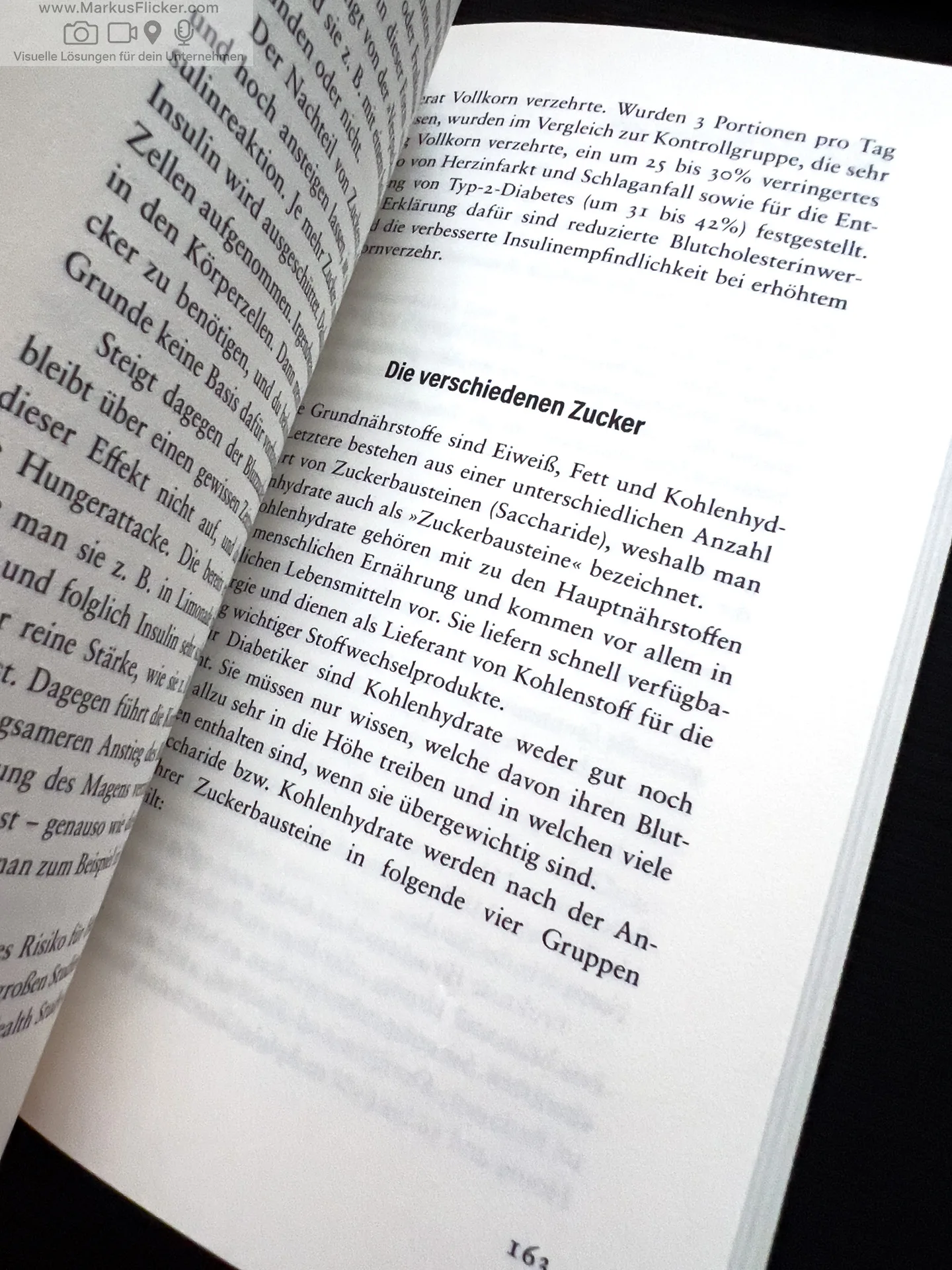 Blutzuckerwerte verstehen - Diabetes heilen: Schutz und Neustart für die Bauchspeicheldrüse mit 5-Wochen-Plan von Dr. Andrea Flemmer Blutzuckerwerte verstehen - Diabetes heilen: Schutz und Neustart für die Bauchspeicheldrüse mit 5-Wochen-Plan von Dr. Andrea Flemmer